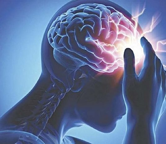 Top 3 đối tượng có nguy cơ đột quỵ cao hơn người thường