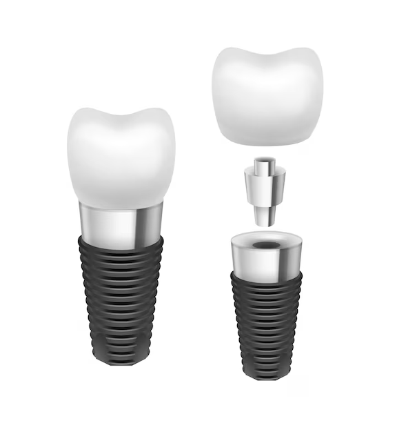 ột trong những yếu tố quyết định đến giá cả giữa cầu răng sứ và Implant chính là vật liệu sử dụng