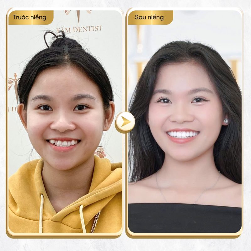 Nha khoa Tấm Dentist - Hệ thống nha khoa thẩm mỹ hàng đầu